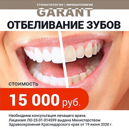 Отбеливание Зубов 