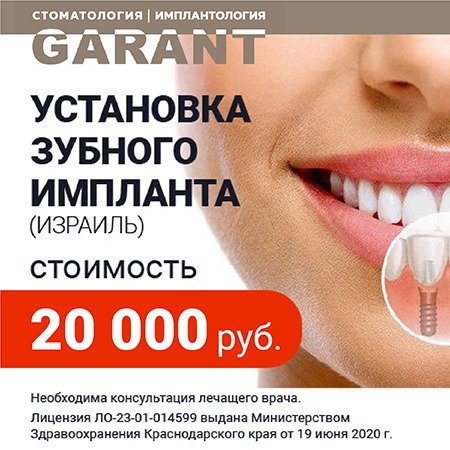 Имплантация Зубов 