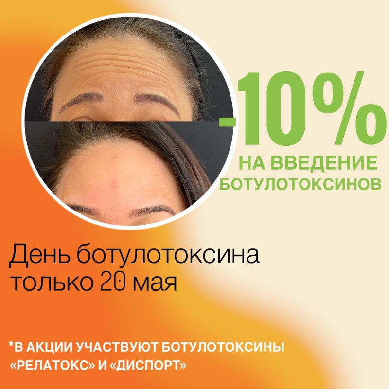 -10% на ботулотоксины