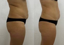 Программа "Spa-детокс"