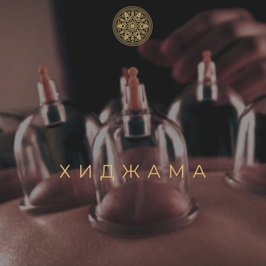 ХИДЖАМА