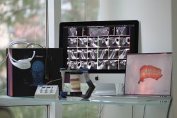 Гнатология