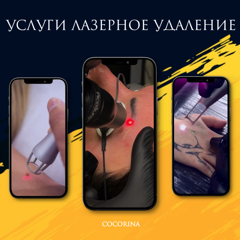 Лазерное удаление некачественного перманентного макияжа бровей