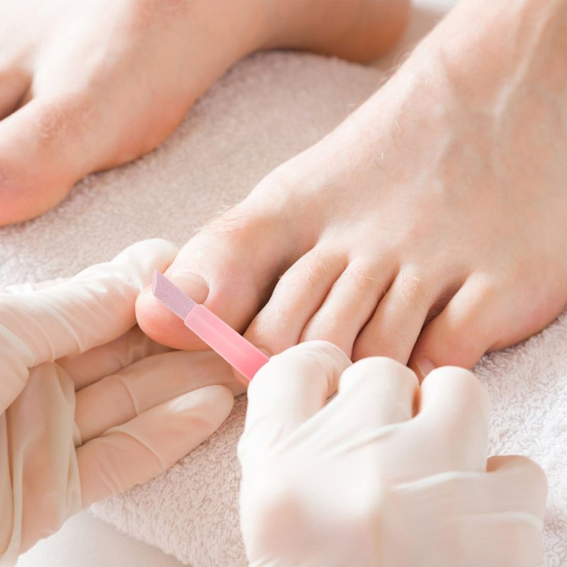 Комплексный подологический педикюр