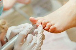 Современные методы: реконструкция (с зачисткой)