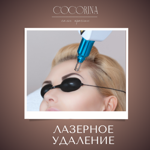 Лазерное удаление татуировки