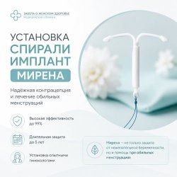 УСТАНОВКА СПИРАЛИ ИМПЛАНТ МИРЕНА