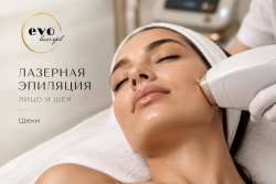 Лазерная эпиляция щек
