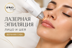 Лазерная эпиляция верхней губы