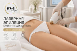 Лазерная эпиляция классического бикини
