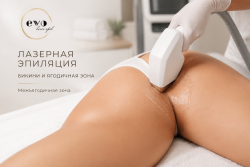 Лазерная эпиляция межъягодичной зоны