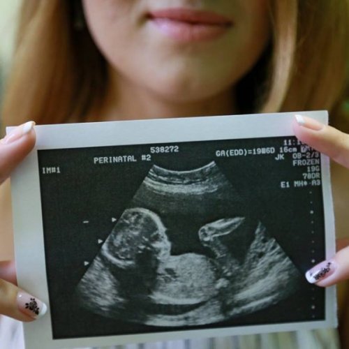 Качественное и доступное по цене УЗИ в медицинском кабинете ПАН Б.В.