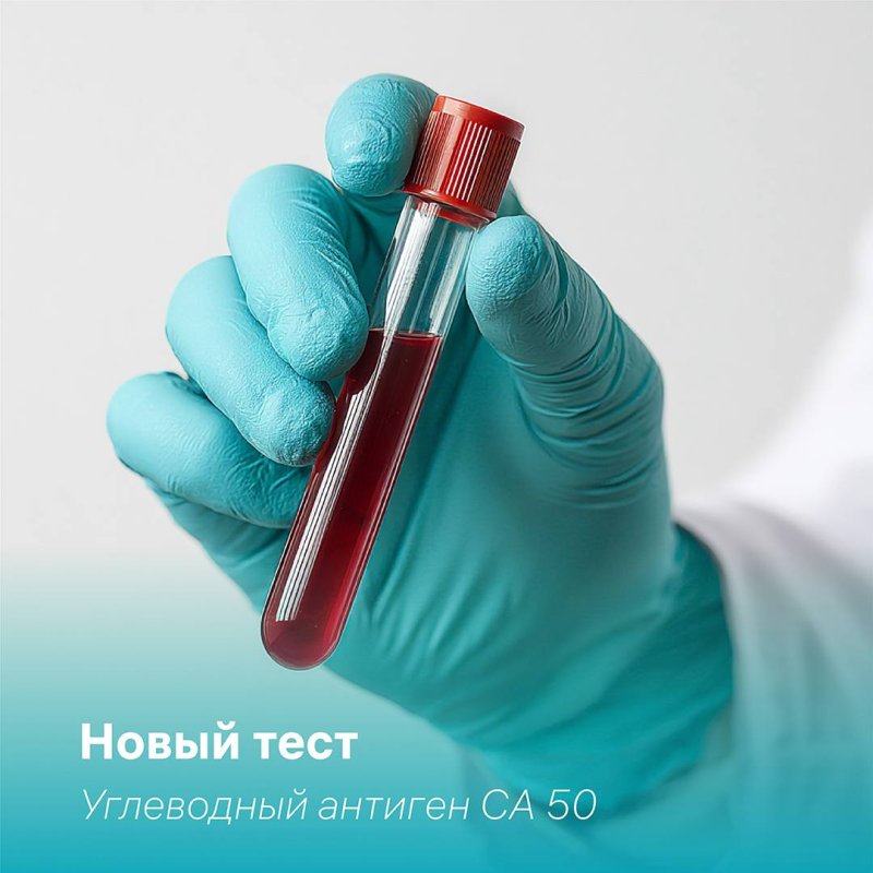 🧪Углеводный антиген CA 50: новый тест в ИНВИТРО