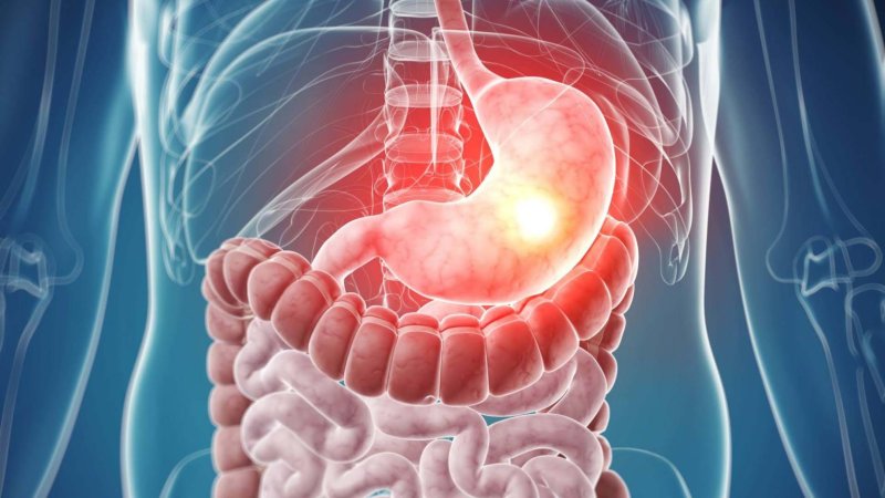 Диагностика состояния желудочно-кишечного тракта в МО ИНВИТРО