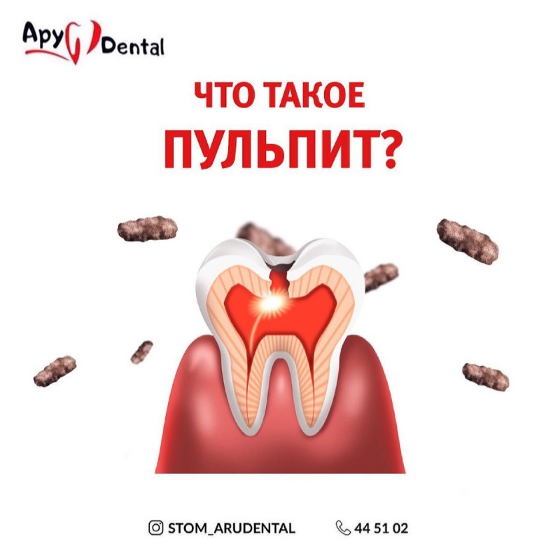 Ару Дентал Актобе. Стомотологии в Актобе. Лечение удаление зубов в Актобе 