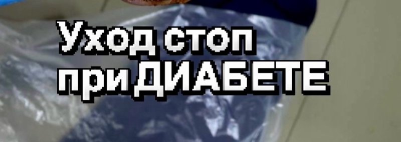 Диабет и подолог👌