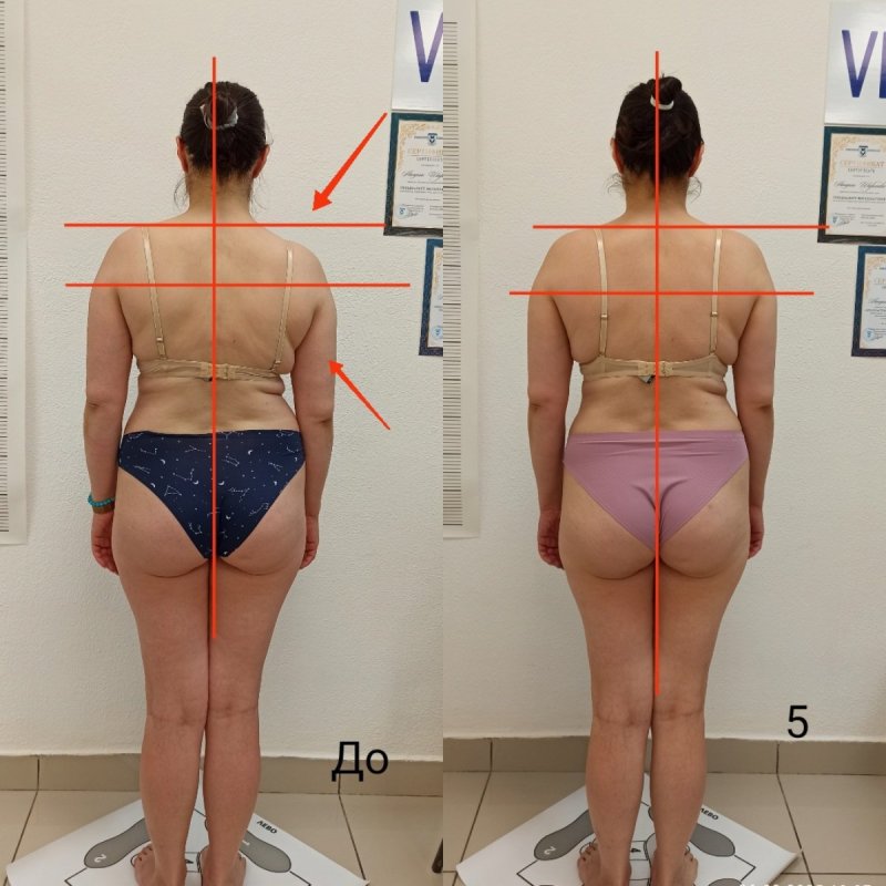 Витапластика Октябрьский