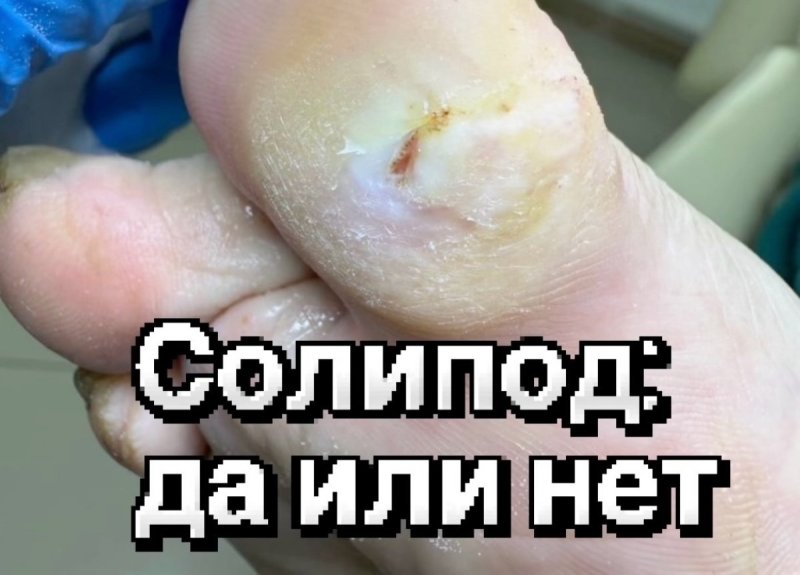 Солипод: да или нет?