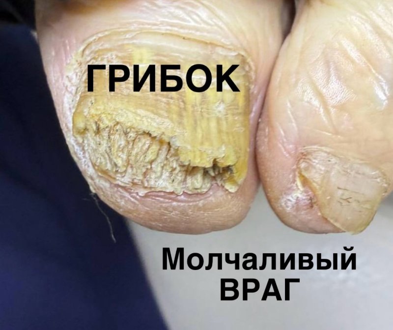 Молчаливый враг.