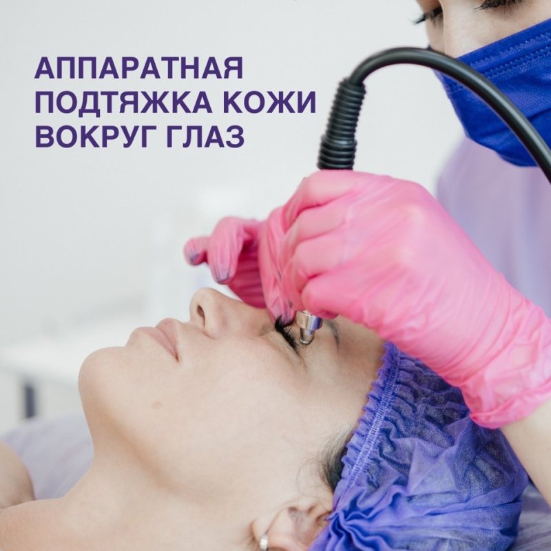 Аппаратная подтяжка кожи вокруг глаз. 