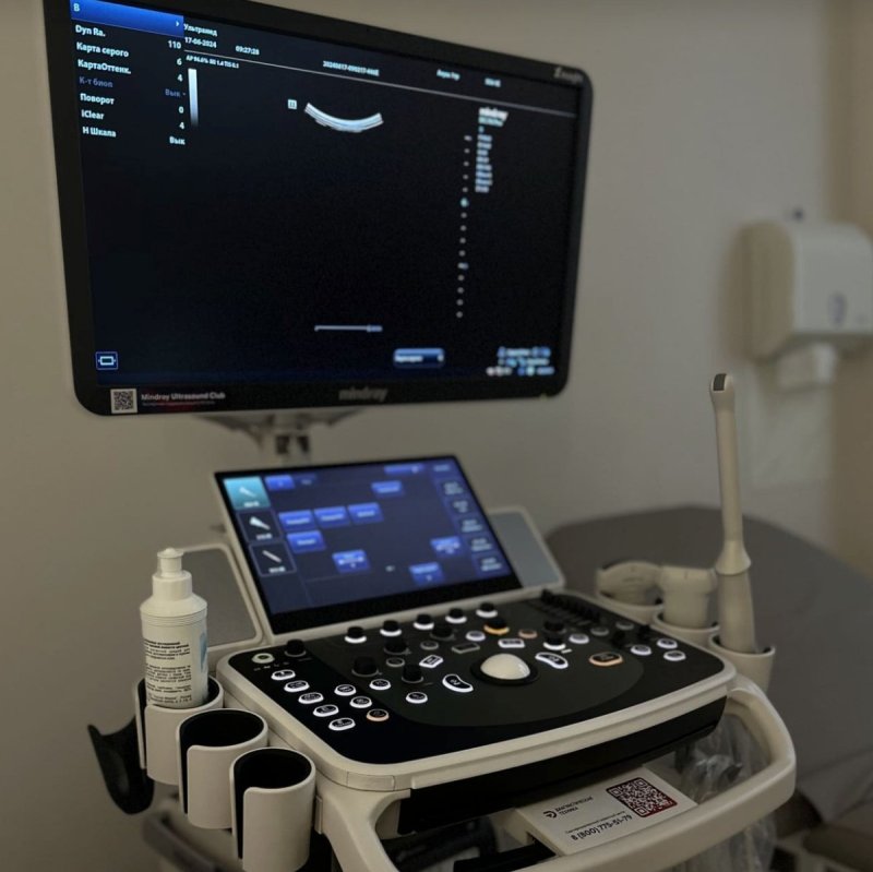 Эластометрия печени в Сочи