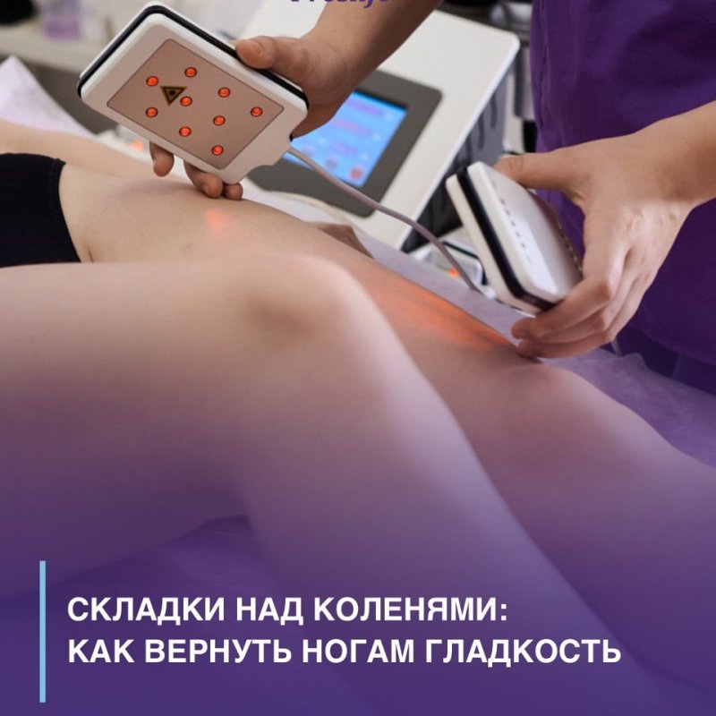 Складки над коленями: как вернуть ногам гладкость 🌸