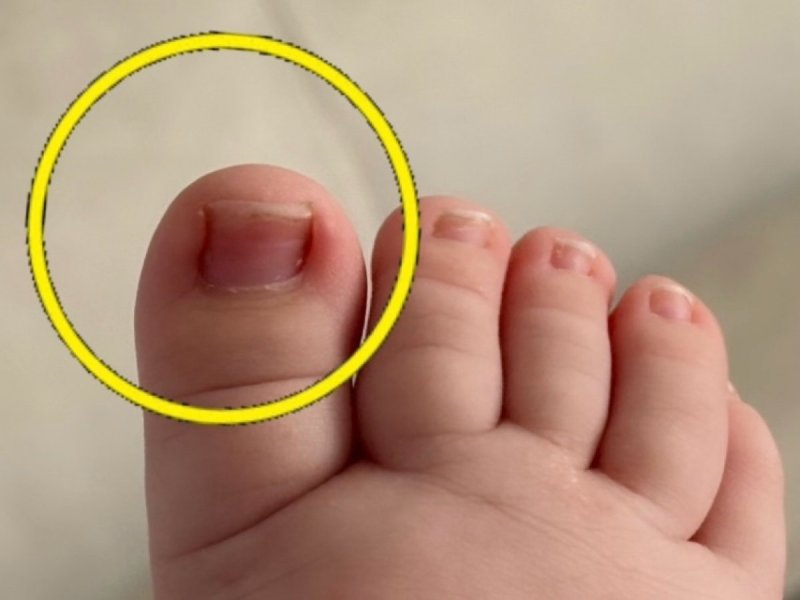 История одного лялепупса👶 