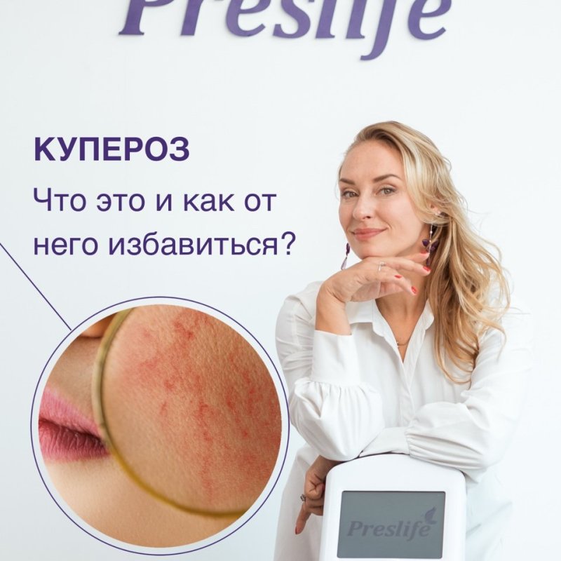 КУПЕРОЗ ⬇️