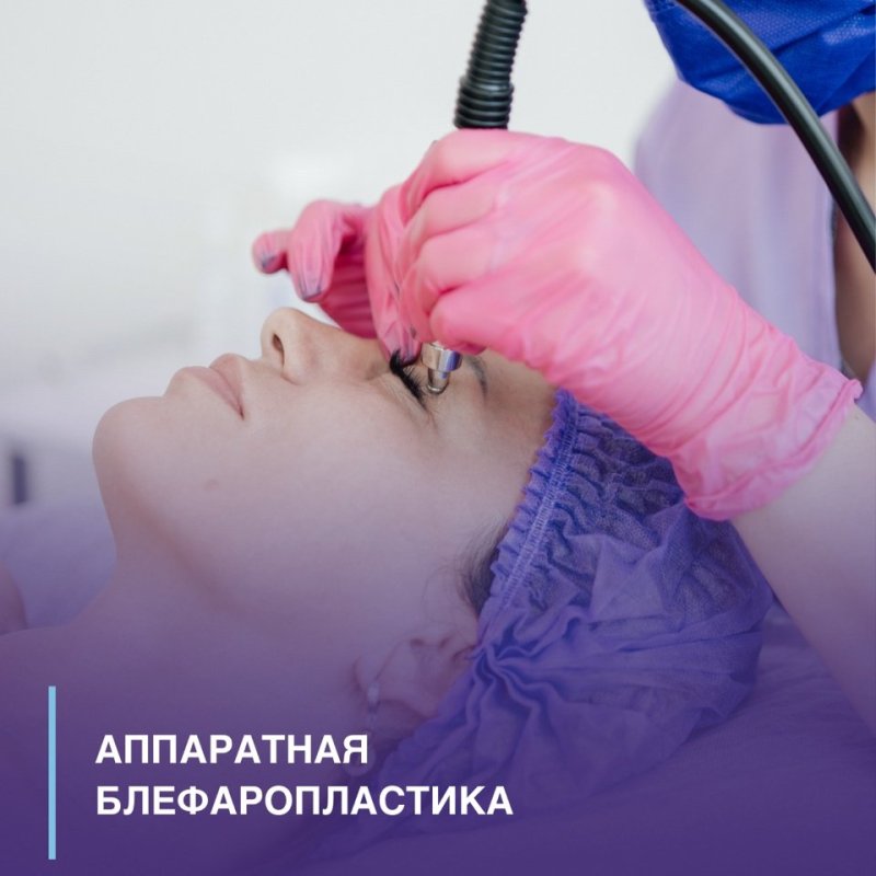 Аппаратная Блефаропластика🦋