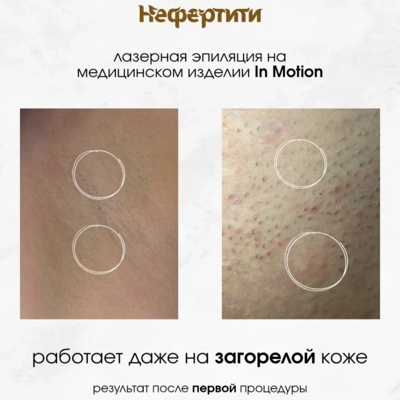  Совершенство – это естественно! 