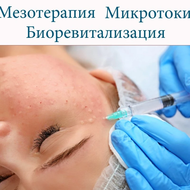 Мезотерапия Биоревитализация Микротоки 