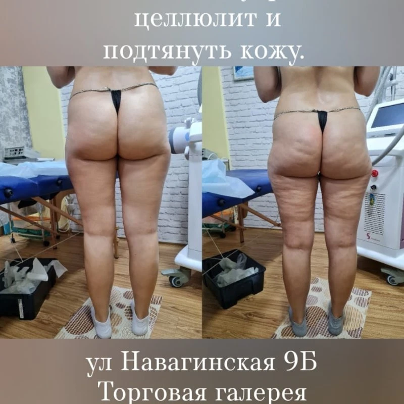 Технологии Skills Body VS III Творят чудеса! 