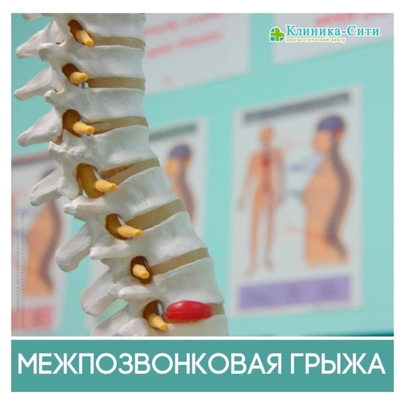 Клиника Сити Майкоп • МРТ КТ УЗИ анализы врачи