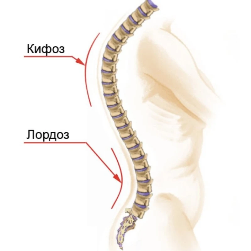 Лордоз, кифоз