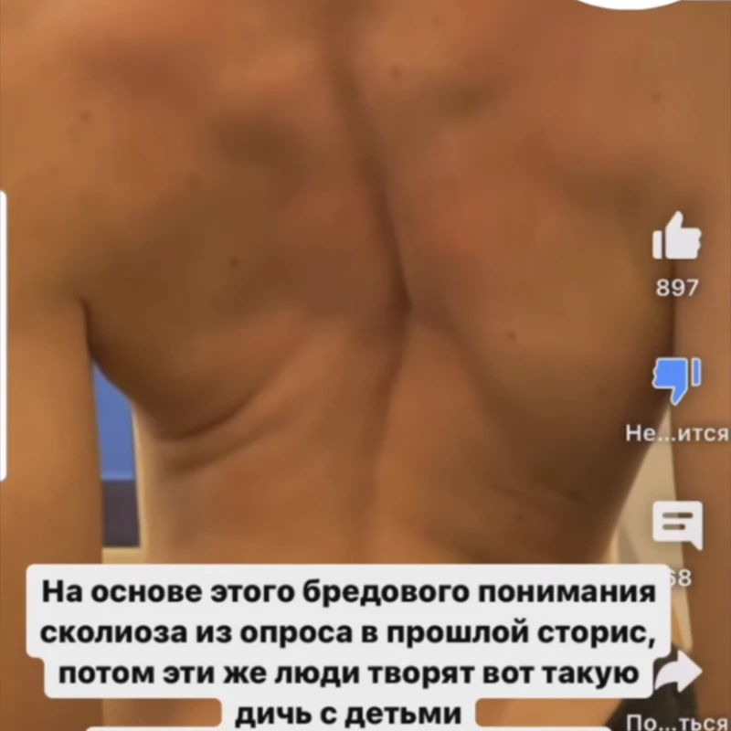 Почему детям со сколиозом нельзя делать активные разгибания в грудном отделе?⠀