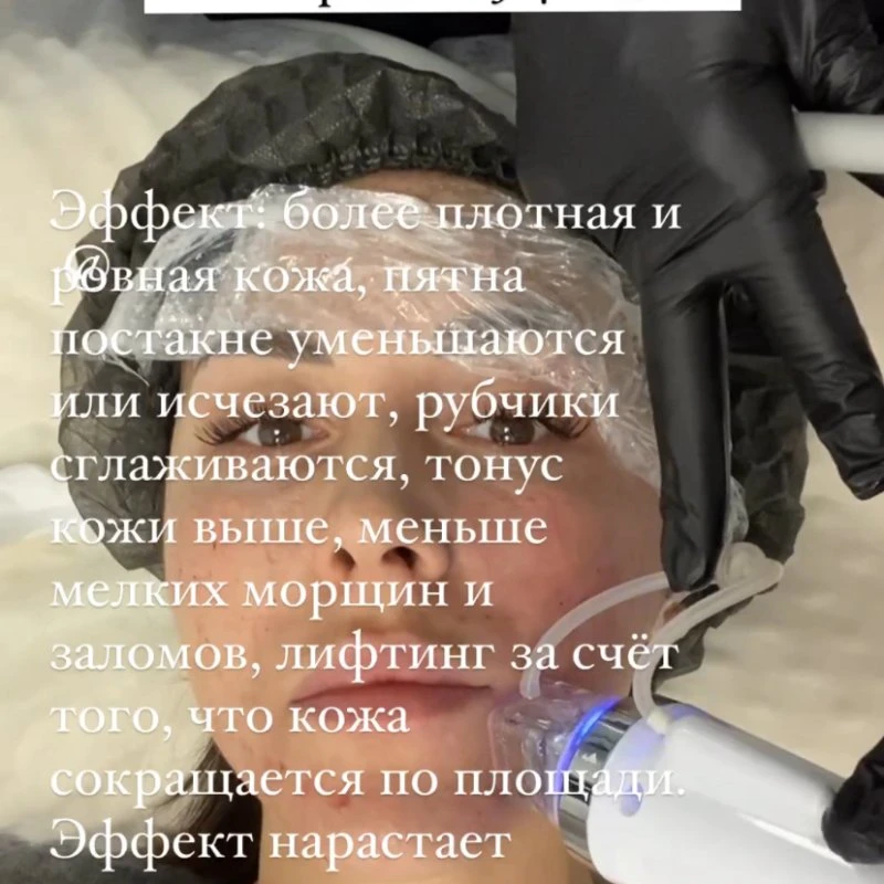 Тотальное омоложение 💯
