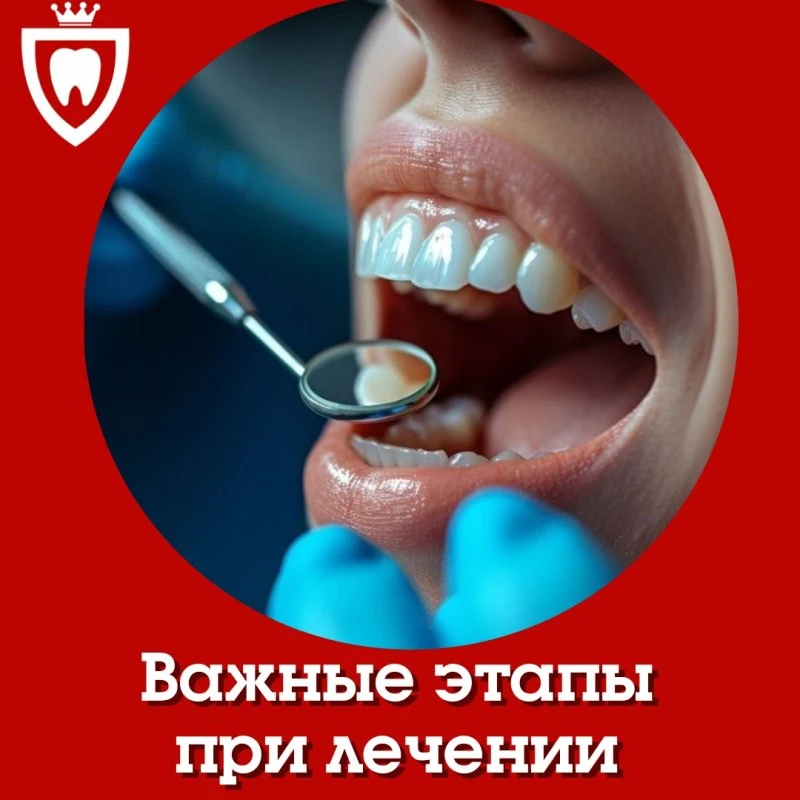 🦷 Три важных этапа при лечении зубов в «Эстедент» 🦷