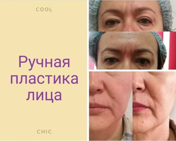 Face Lifting Aktobe