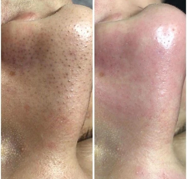 Beauty spaterapia