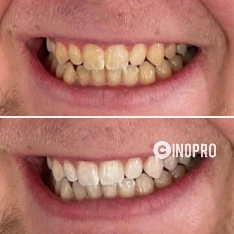 inoPro Professional Care