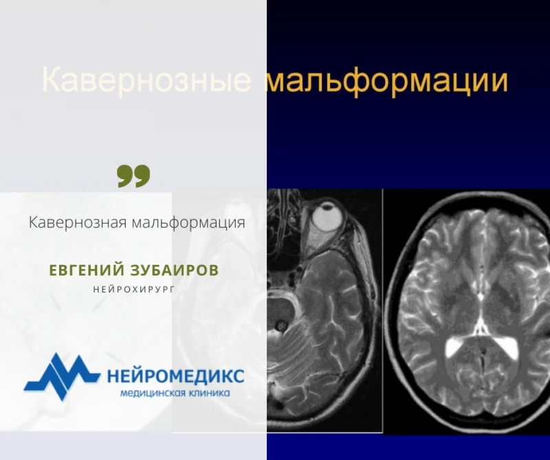 Нейромедикс
