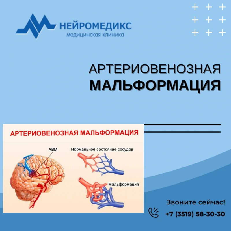 Нейромедикс