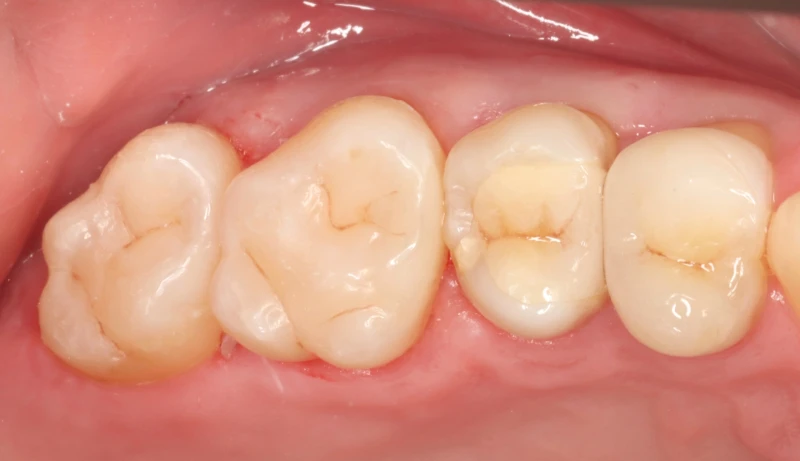 All Dental