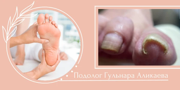 Подолог Аликаева Гульнара