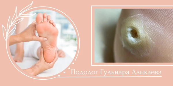 Подолог Аликаева Гульнара