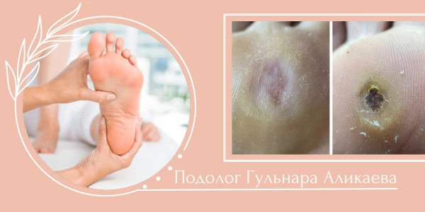 Подолог Аликаева Гульнара