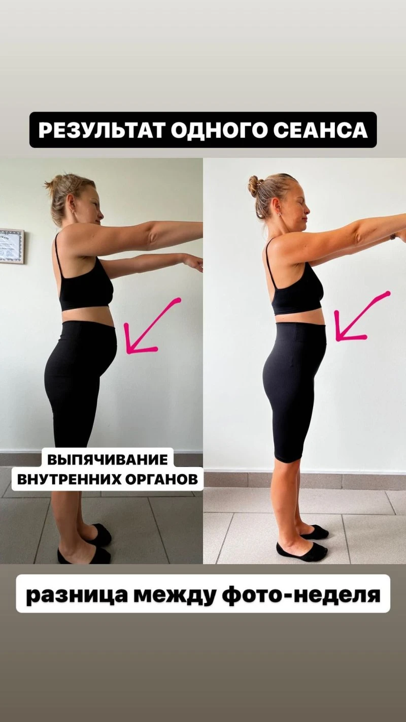 Остеопат
