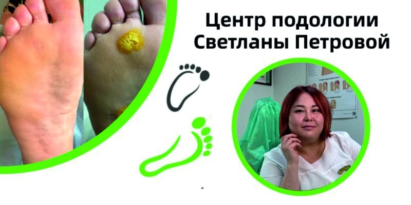 Центр подологии  Светланы Петровой