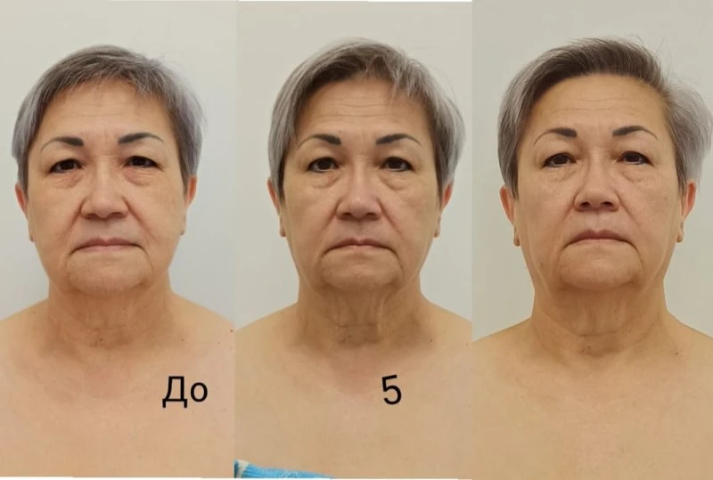 Специалист Витапластики Ландыш Шарипова