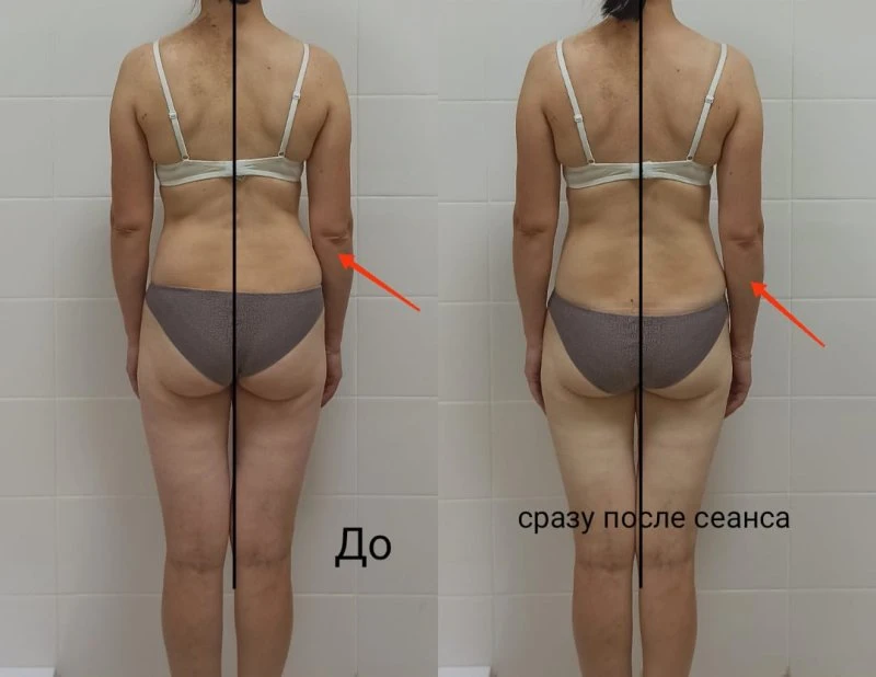 Специалист Витапластики Ландыш Шарипова